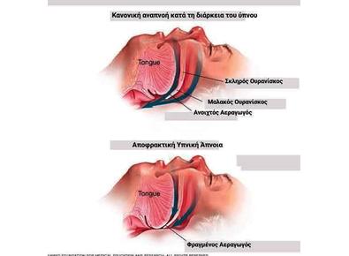 Article_image_images__2_