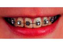 Article_thumb_1000002672