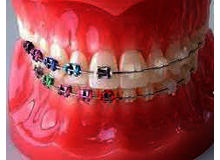 Article_thumb_unnamed