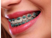 Article_thumb_1000002760
