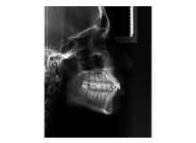 Article_thumb_1000001955