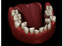 Article_thumb_1000004047